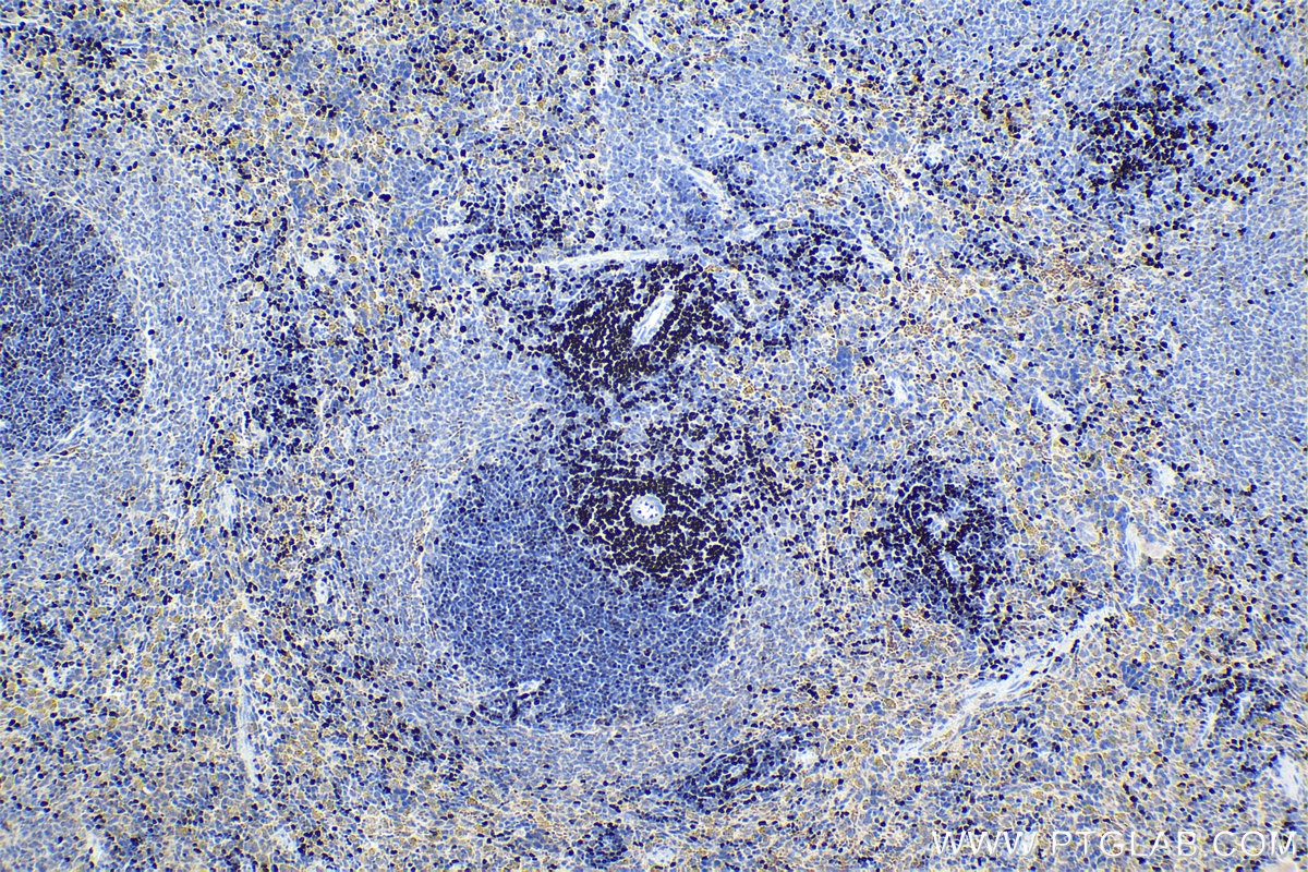 Immunohistochemistry (IHC) staining of rat spleen tissue using SATB1 Polyclonal antibody (15400-1-AP)