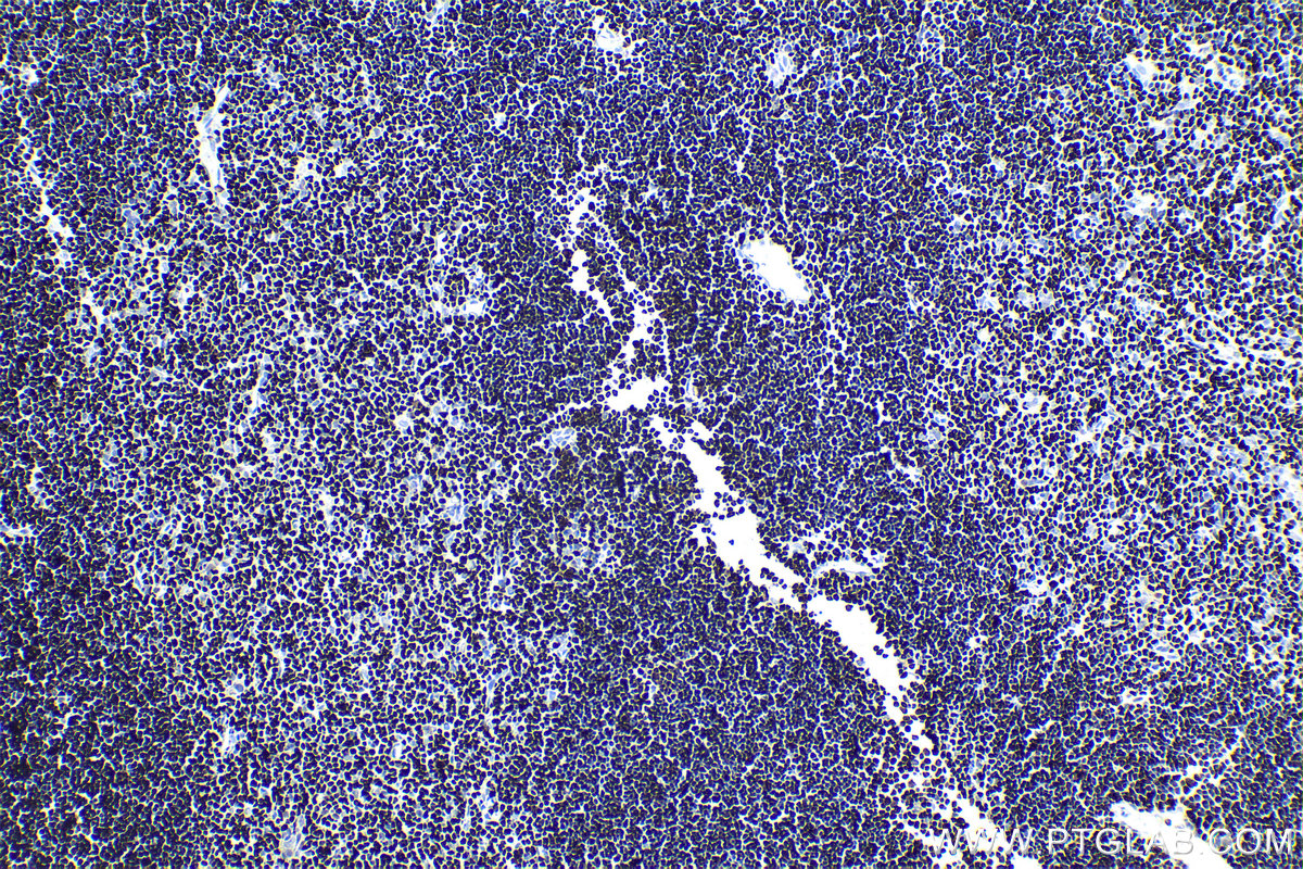 Immunohistochemistry (IHC) staining of rat thymus tissue using SATB1 Polyclonal antibody (15400-1-AP)