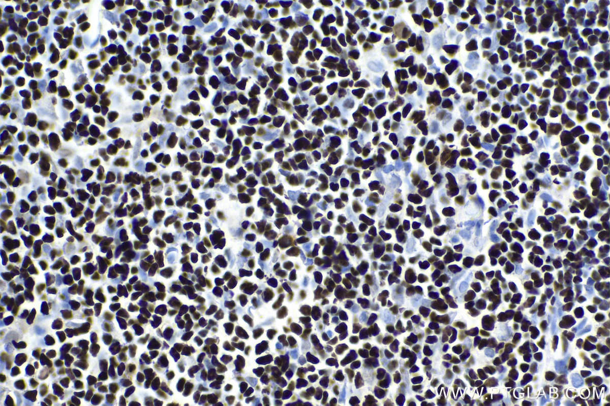 Immunohistochemistry (IHC) staining of rat thymus tissue using SATB1 Polyclonal antibody (15400-1-AP)