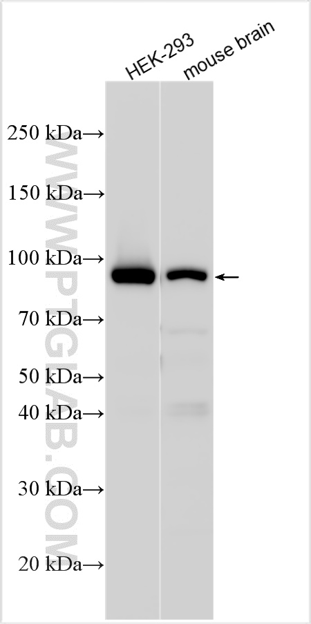 Western Blot (WB) analysis of various lysates using SATB2 Polyclonal antibody (30717-1-AP)
