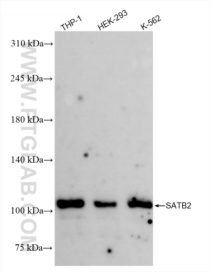 Western Blot (WB) analysis of various lysates using SATB2 Recombinant antibody (85922-3-RR)