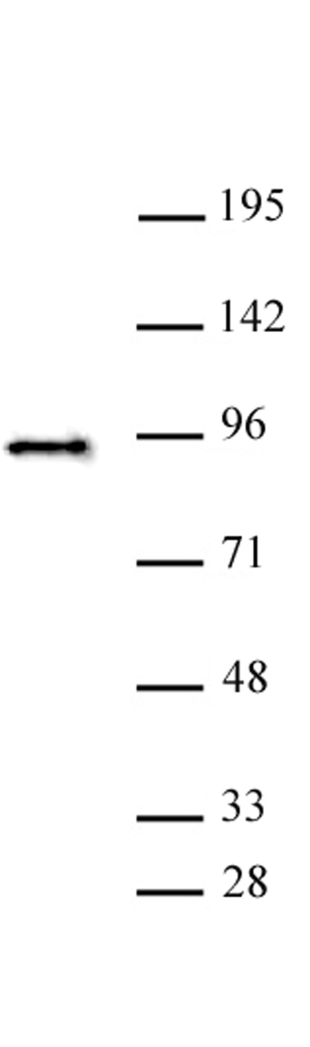 SATB2 antibody (pAb) tested by Western blot. SATB2 antibody detection by Western blot. The analysis was performed using 20 ug Saos-2 nuclear extract and SATB2 antibody at a 1:500 dilution.