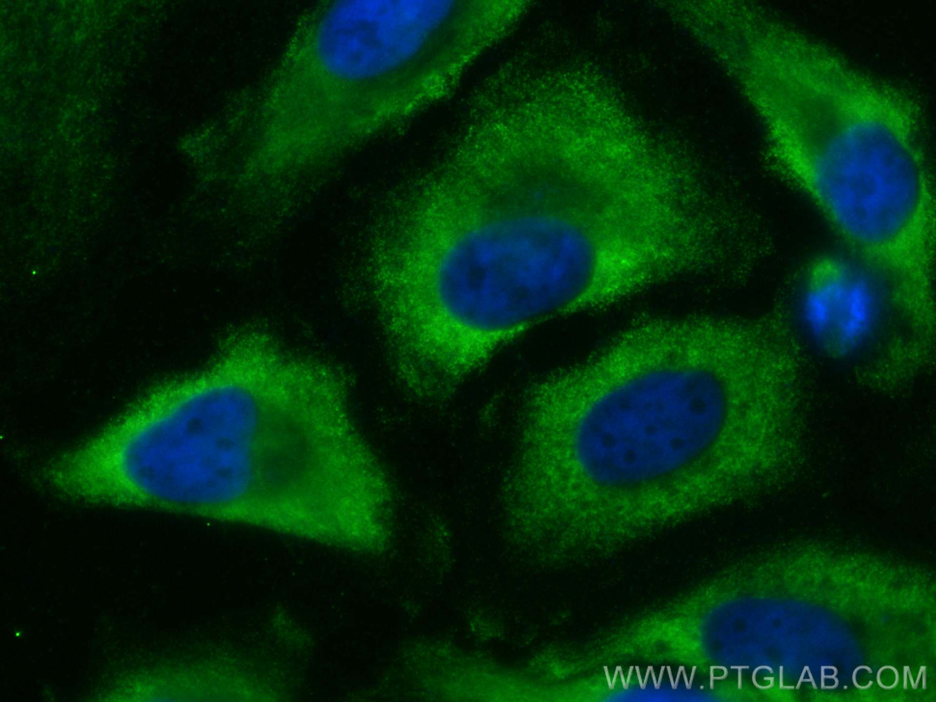 Immunofluorescence (IF) / fluorescent staining of HeLa cells using CoraLite® Plus 488-conjugated SCAMP3 Monoclonal an (CL488-67932)