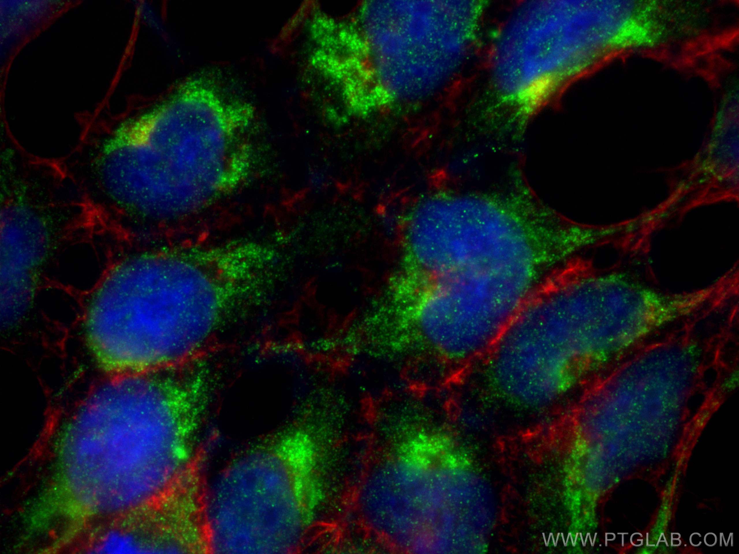 Immunofluorescence (IF) / fluorescent staining of HEK-293 cells using SCAP Polyclonal antibody (12266-1-AP)