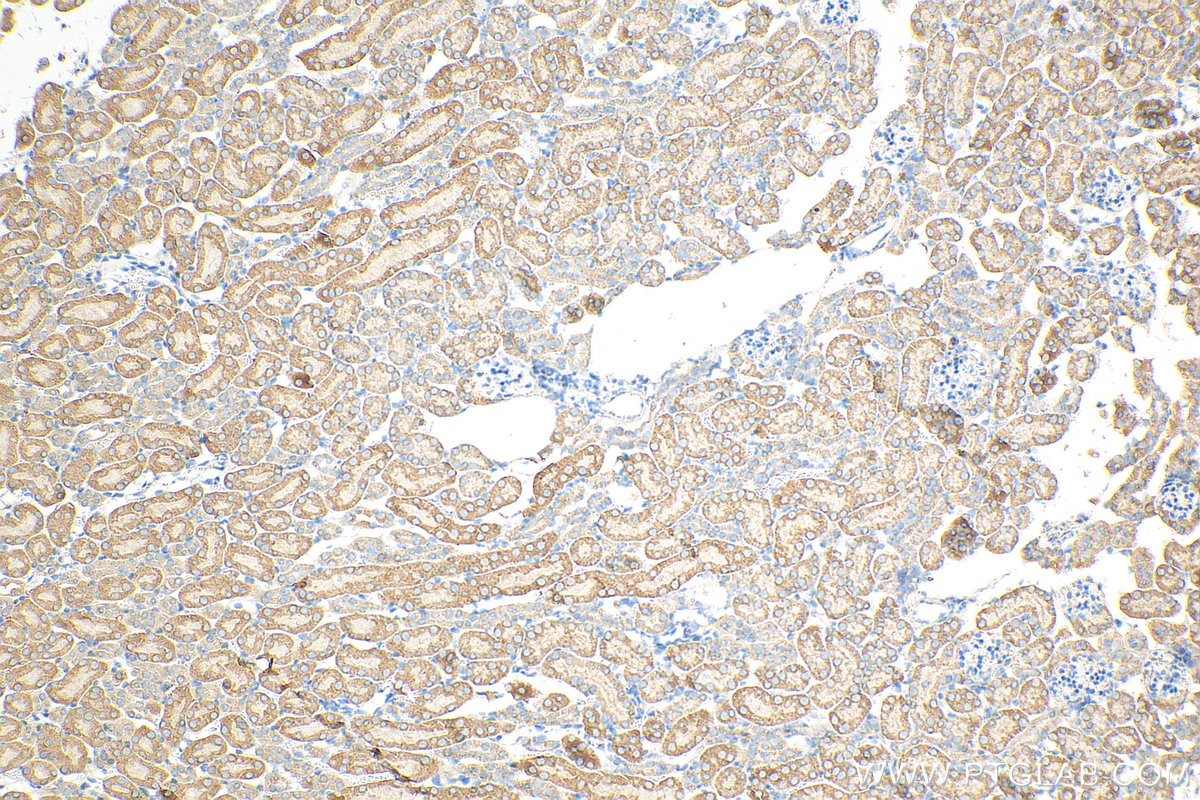 Immunohistochemistry (IHC) staining of mouse kidney tissue using SCAP Polyclonal antibody (12266-1-AP)