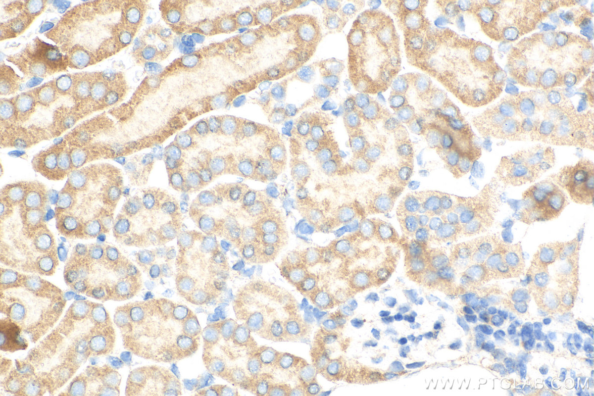 Immunohistochemistry (IHC) staining of mouse kidney tissue using SCAP Polyclonal antibody (12266-1-AP)