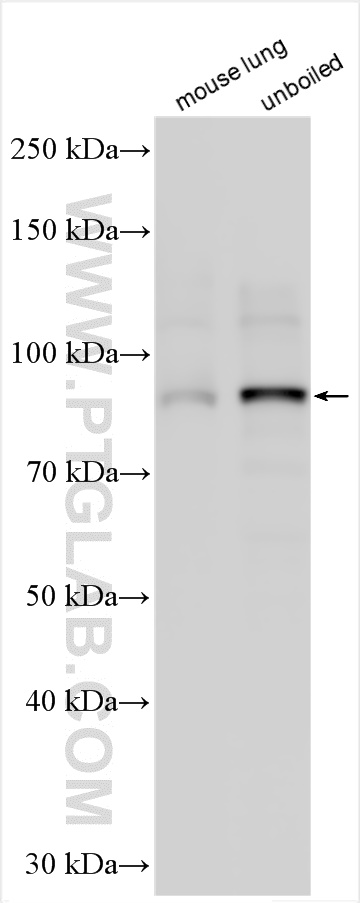 Western Blot (WB) analysis of various lysates using SCARF1 Polyclonal antibody (13702-1-AP)