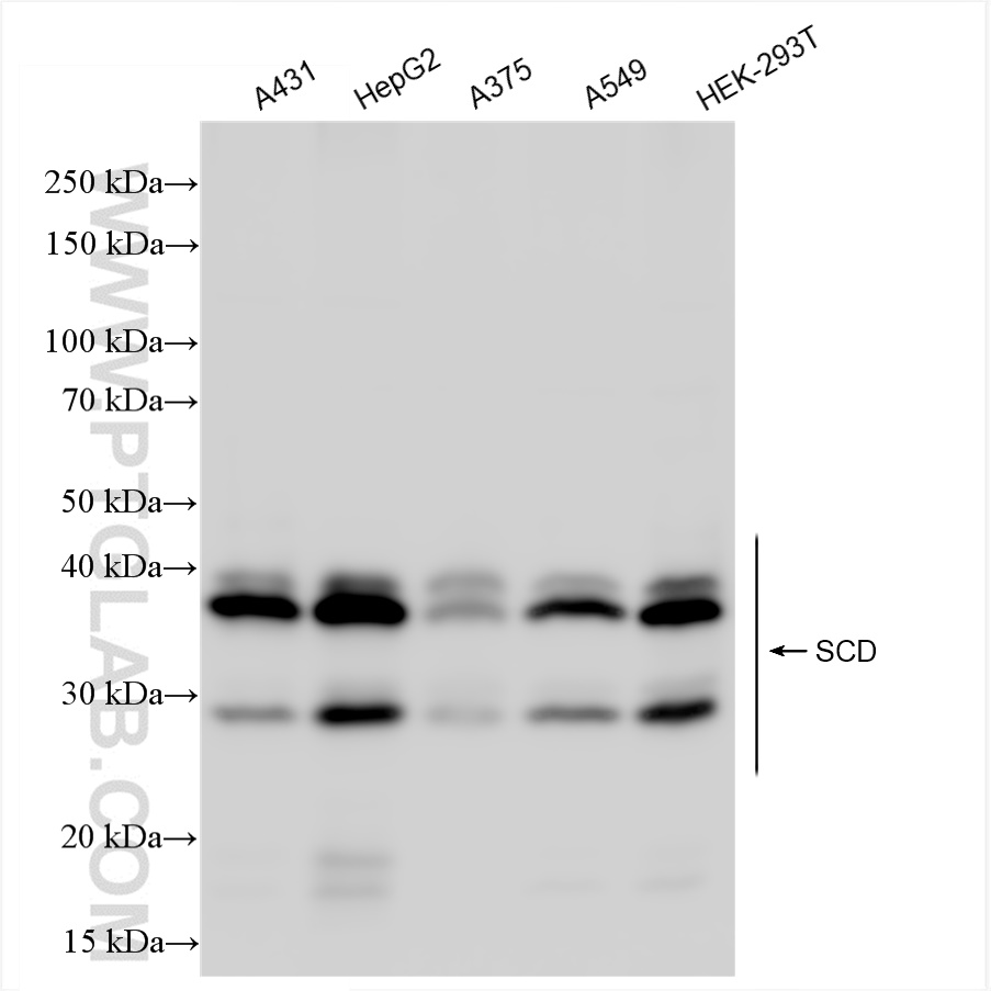 Western Blot (WB) analysis of various lysates using SCD Recombinant antibody (81468-2-RR)