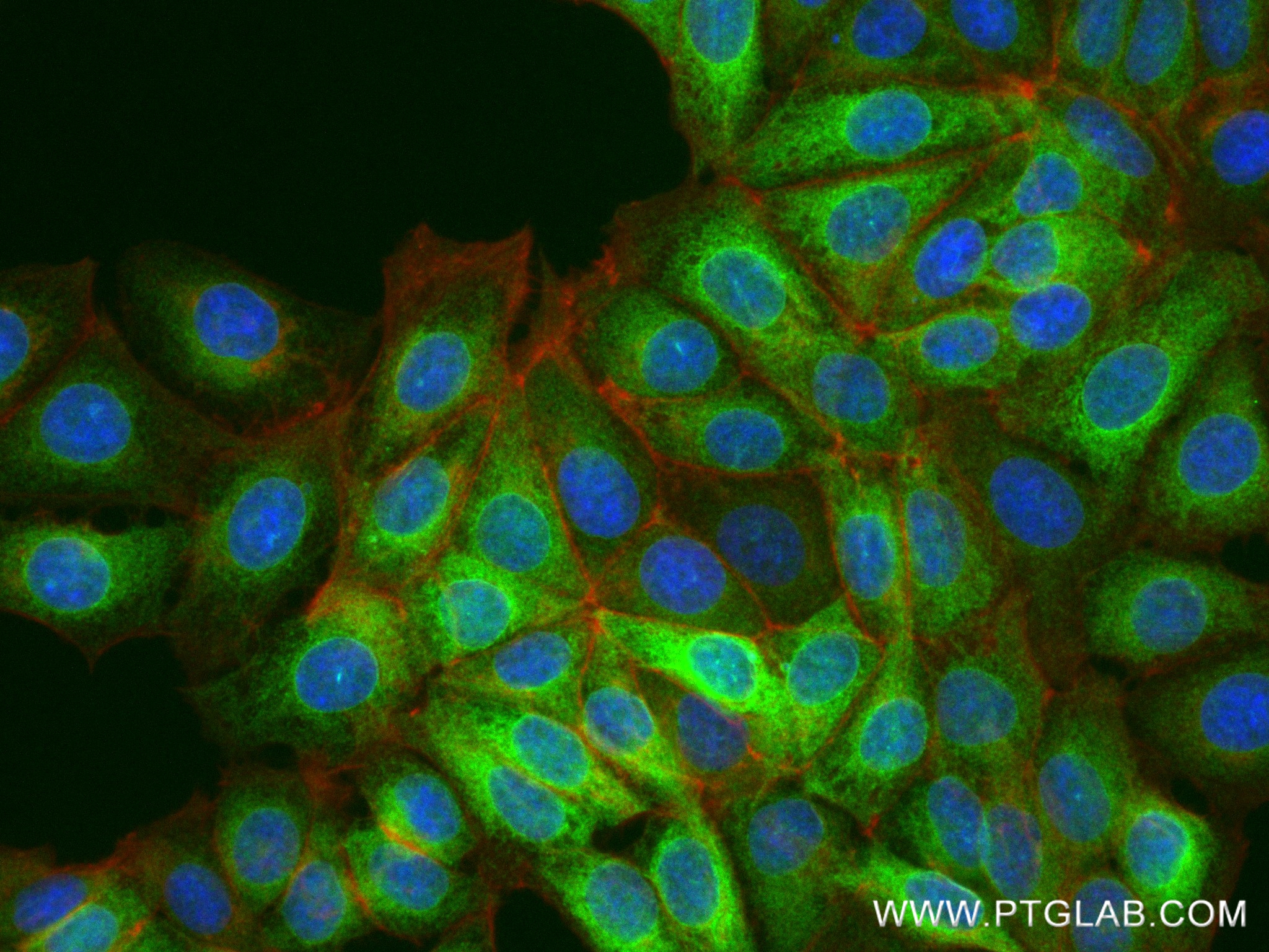 Immunofluorescence (IF) / fluorescent staining of MCF-7 cells using SCD1 Recombinant antibody (81468-5-RR)