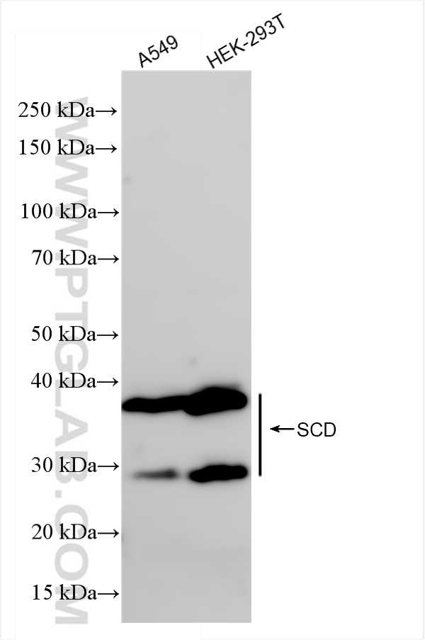 Western Blot (WB) analysis of various lysates using SCD1 Recombinant antibody (81468-5-RR)