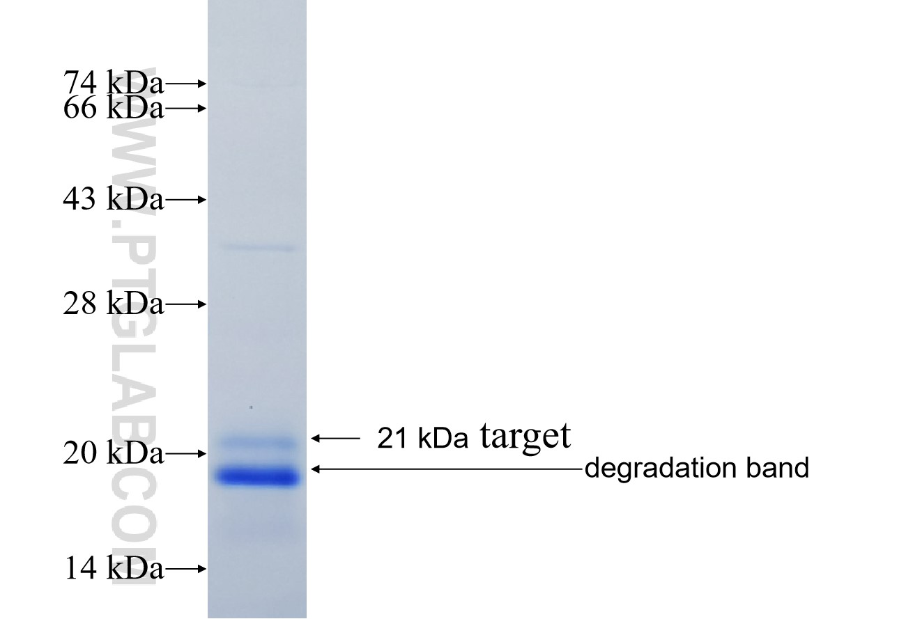 SCD fusion protein Ag29167 SDS-PAGE