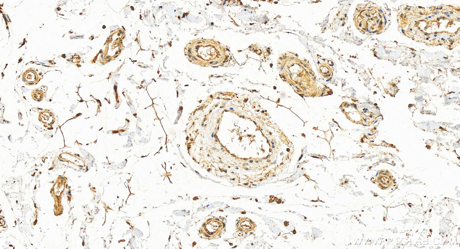 Immunohistochemistry (IHC) staining of human colon tissue using SCFD2 Polyclonal antibody (13375-1-AP)