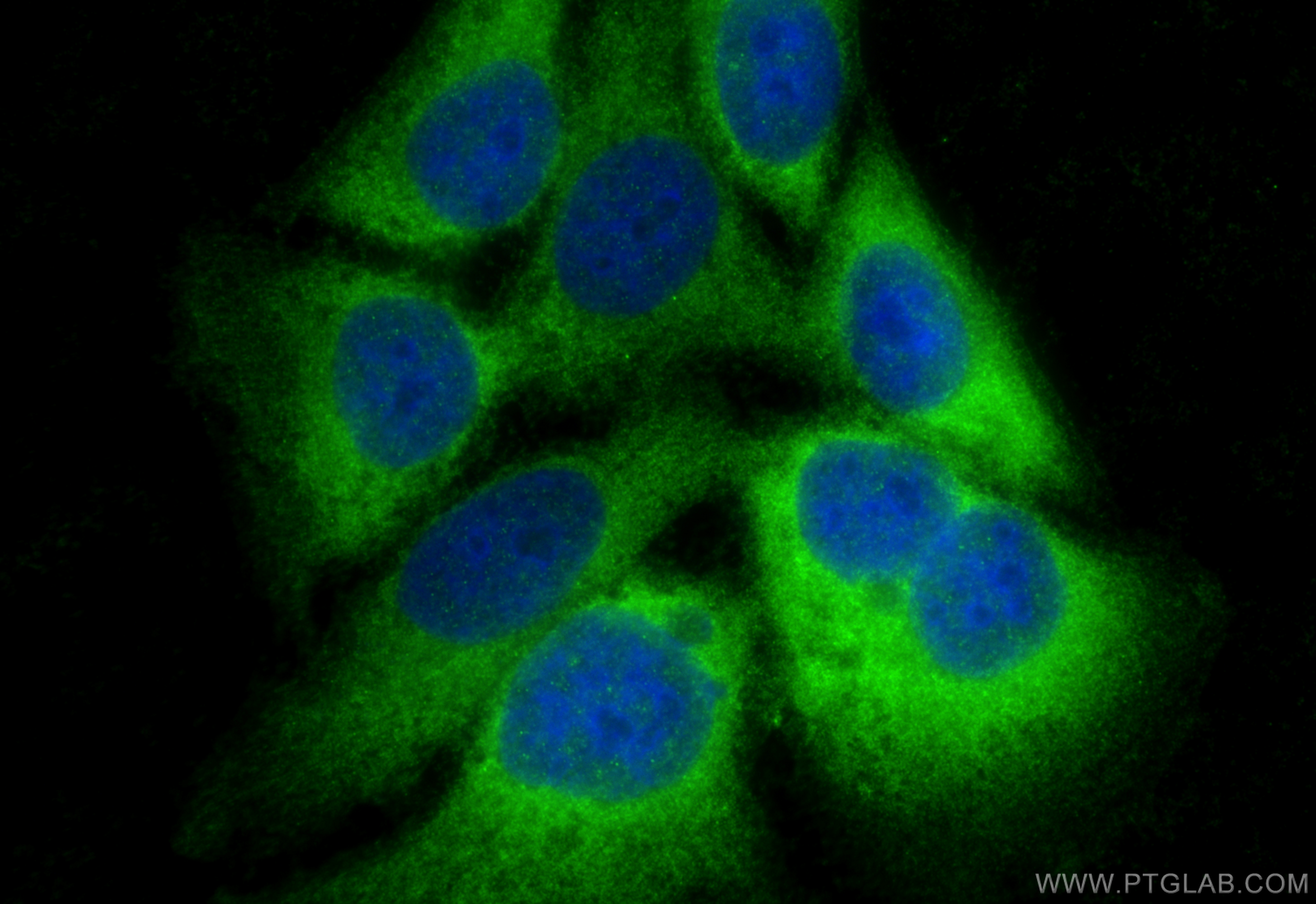 Immunofluorescence (IF) / fluorescent staining of HepG2 cells using SCIN Polyclonal antibody (11579-1-AP)