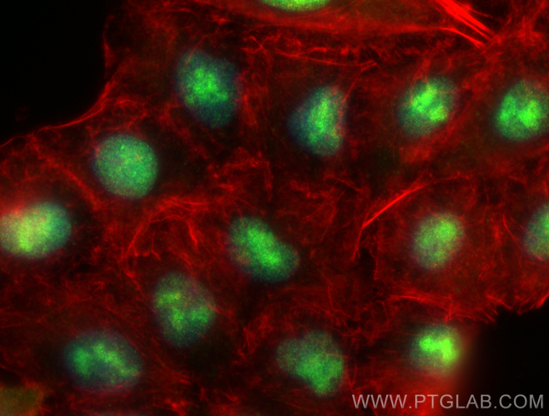 Immunofluorescence (IF) / fluorescent staining of A549 cells using SCML1 Polyclonal antibody (15093-1-AP)