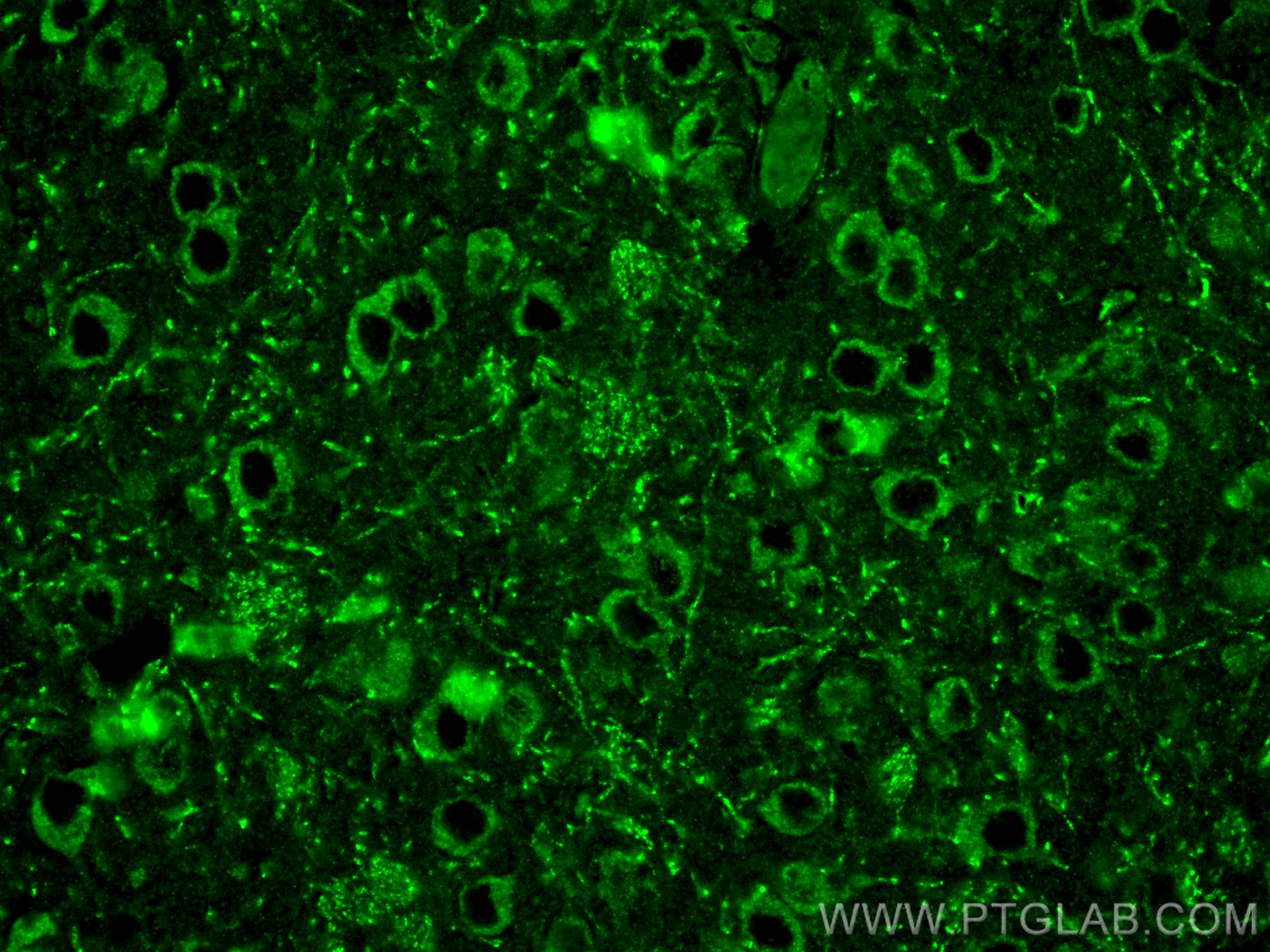 Immunofluorescence (IF) / fluorescent staining of mouse brain tissue using SCN2A Polyclonal antibody (27551-1-AP)