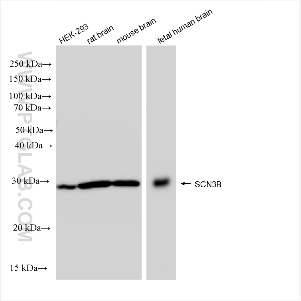 Western Blot (WB) analysis of various lysates using SCN3B Recombinant antibody (82959-7-RR)