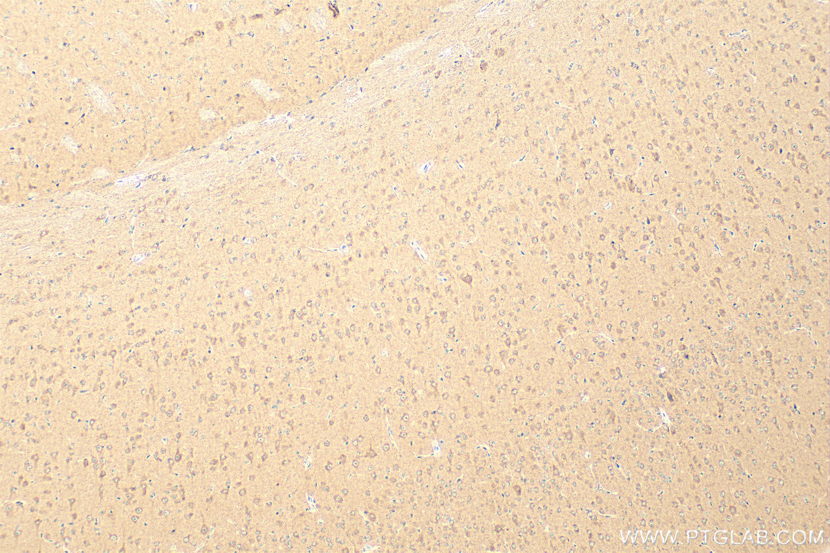 Immunohistochemistry (IHC) staining of mouse brain tissue using SCN9A/Nav1.7-Specific Polyclonal antibody (20257-1-AP)