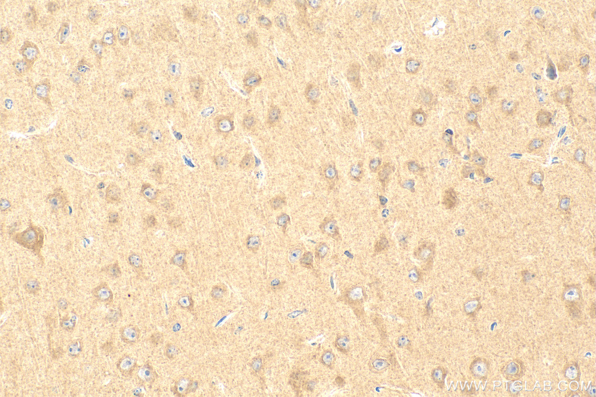 Immunohistochemistry (IHC) staining of mouse brain tissue using SCN9A/Nav1.7-Specific Polyclonal antibody (20257-1-AP)