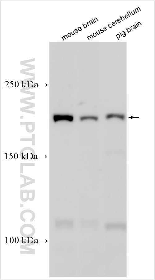 Western Blot (WB) analysis of various lysates using SCN9A/Nav1.7-Specific Polyclonal antibody (20257-1-AP)