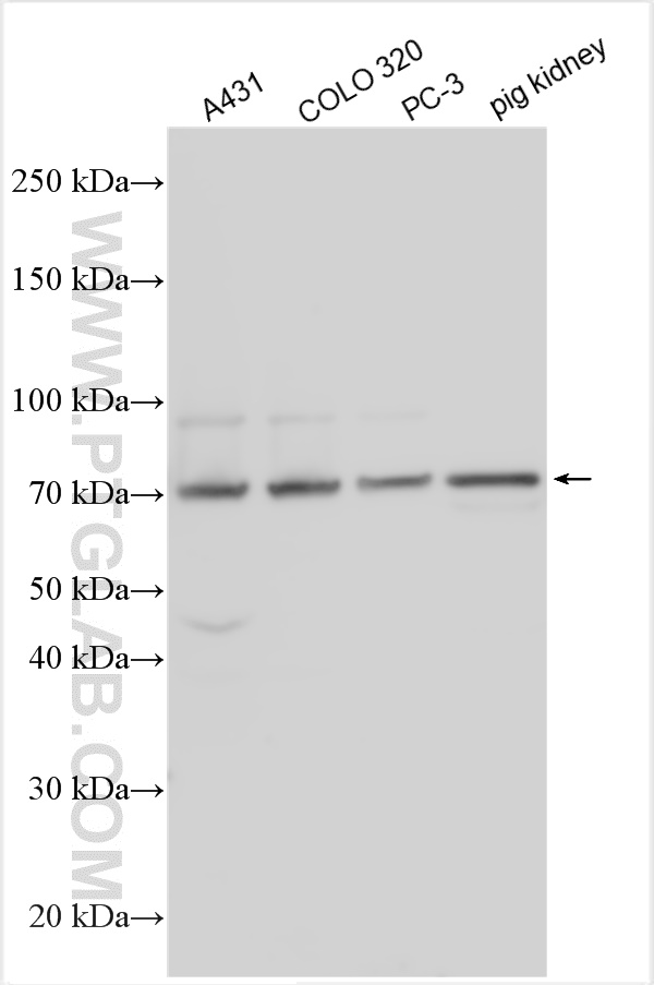 Western Blot (WB) analysis of various lysates using SCNN1G Polyclonal antibody (30037-1-AP)