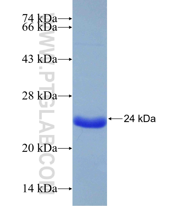 SCO2 fusion protein Ag31122 SDS-PAGE