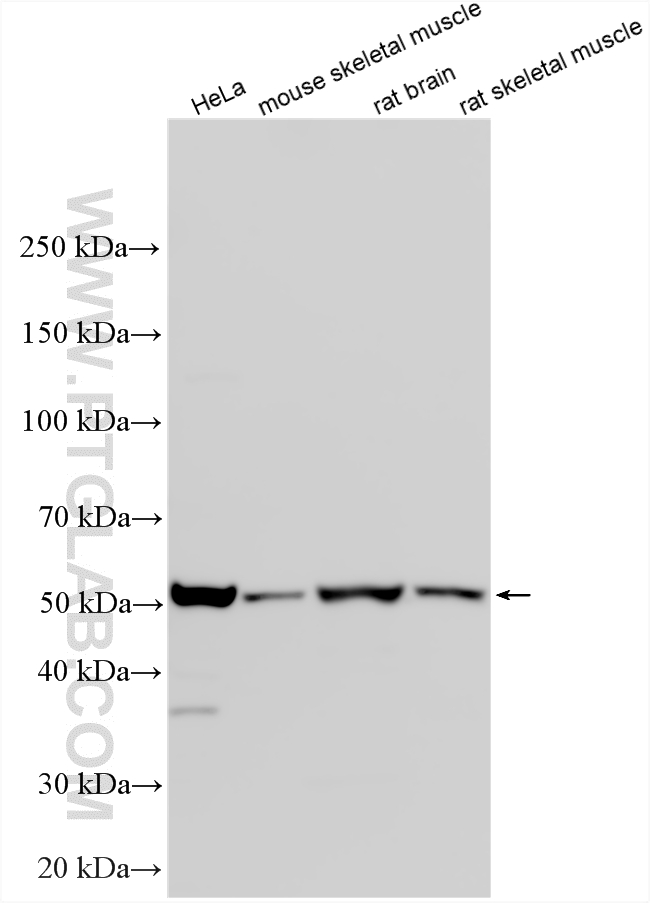 Western Blot (WB) analysis of various lysates using OXCT1 Polyclonal antibody (12175-1-AP)