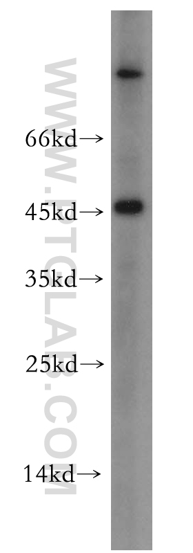 Western Blot (WB) analysis of A2780 cells using SCP2/SCPx Polyclonal antibody (19182-1-AP)