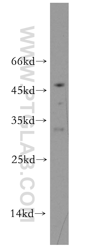 Western Blot (WB) analysis of mouse ovary tissue using SCP2/SCPx Polyclonal antibody (19182-1-AP)