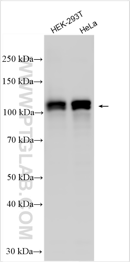 Western Blot (WB) analysis of various lysates using SCYL1 Polyclonal antibody (31302-1-AP)