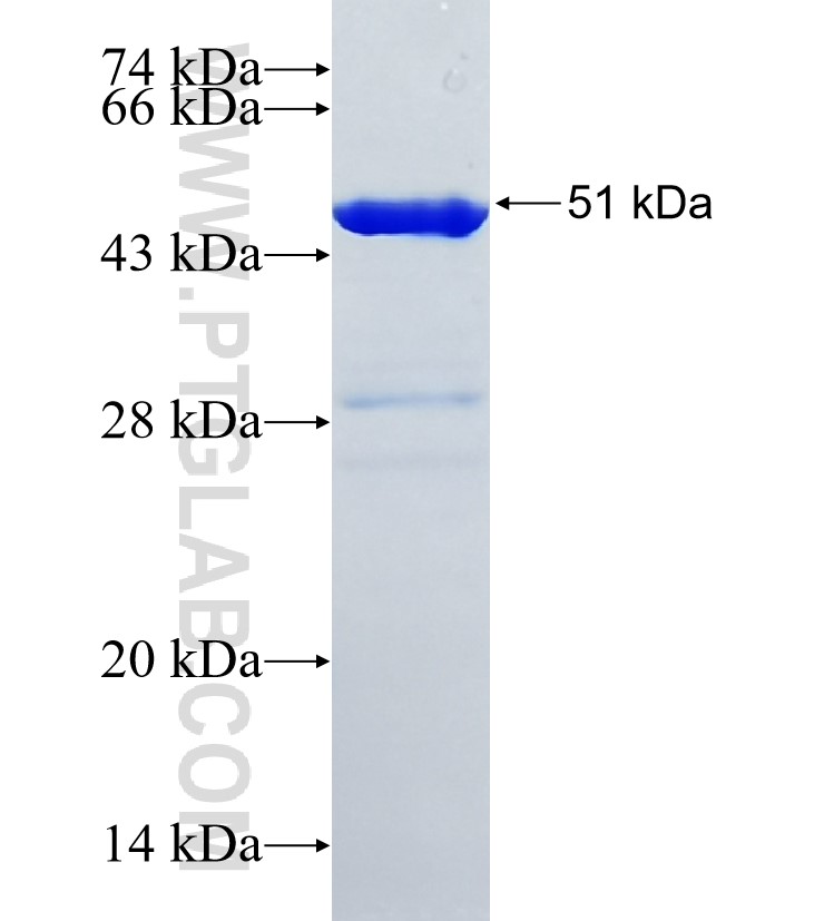 SCYL1 fusion protein Ag35298 SDS-PAGE