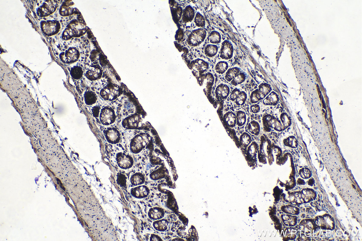 Immunohistochemistry (IHC) staining of rat colon tissue using Syntenin 2 Polyclonal antibody (10407-1-AP)