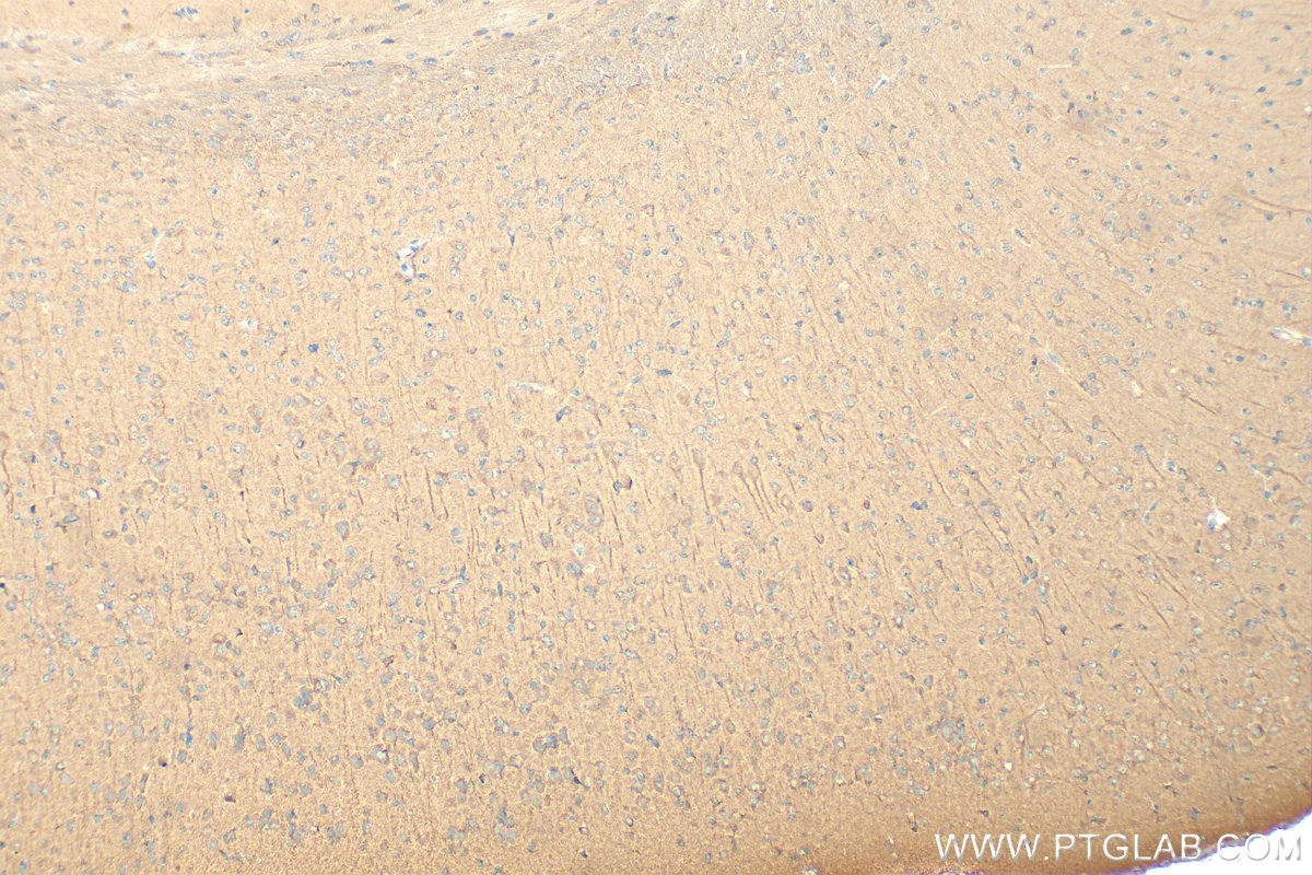 Immunohistochemistry (IHC) staining of mouse brain tissue using SDCCAG8 Polyclonal antibody (13471-1-AP)