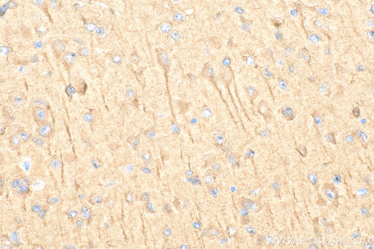 Immunohistochemistry (IHC) staining of mouse brain tissue using SDCCAG8 Polyclonal antibody (13471-1-AP)