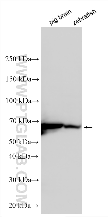 Western Blot (WB) analysis of various lysates using SDHA Polyclonal antibody (14865-1-AP)
