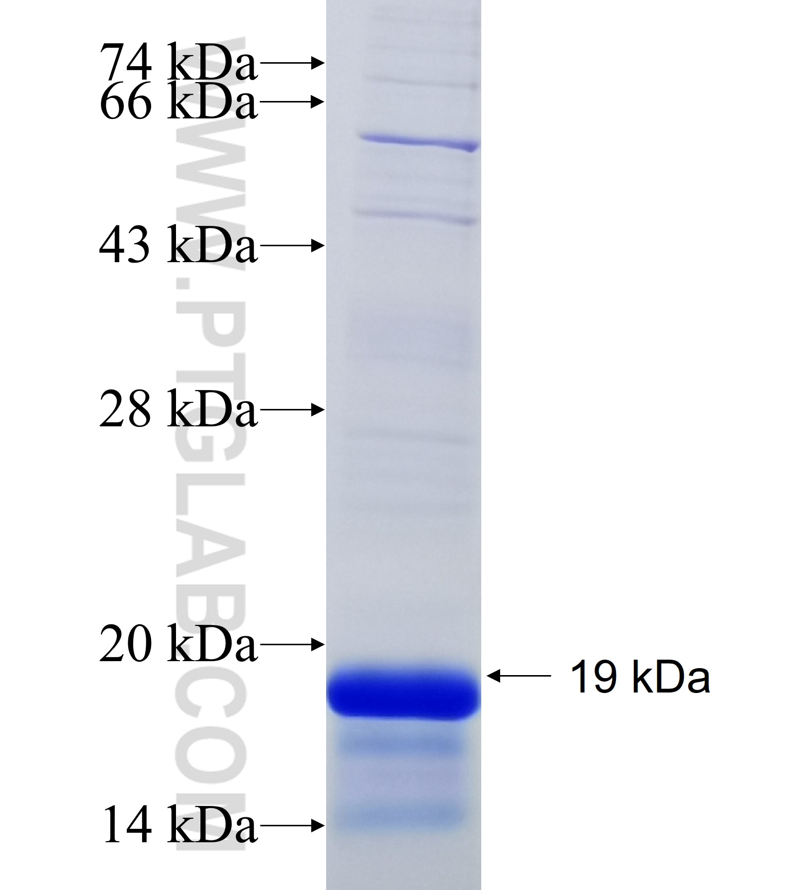 SDHD fusion protein Ag34486 SDS-PAGE