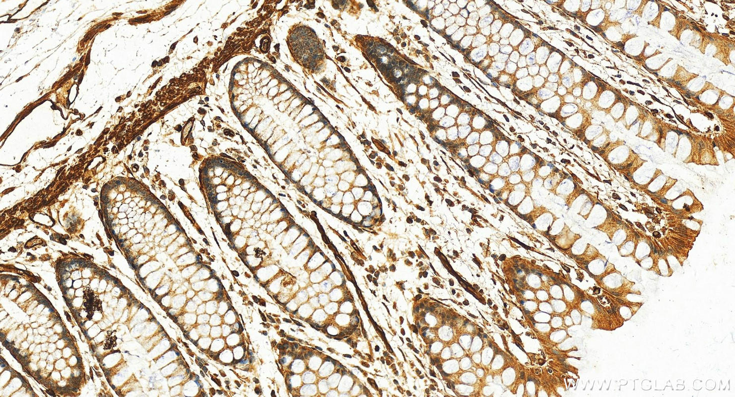 Immunohistochemistry (IHC) staining of human normal colon using SDPR Polyclonal antibody (12339-1-AP)