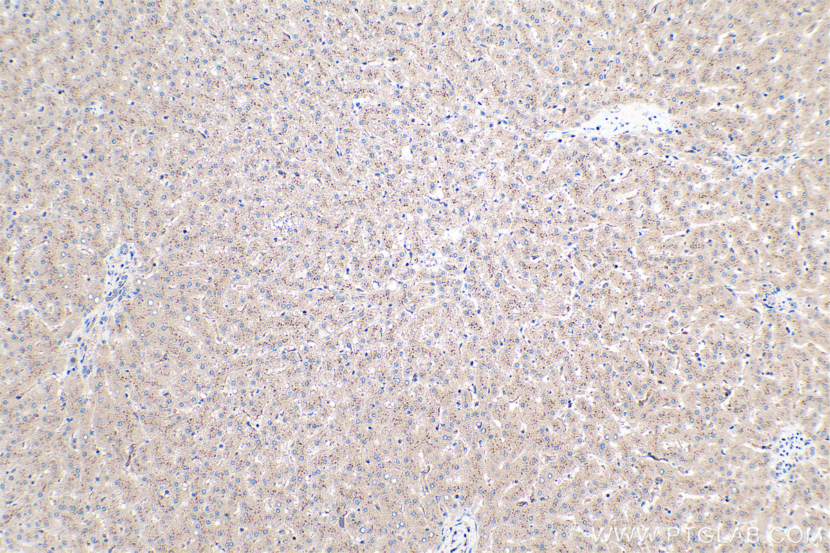 Immunohistochemistry (IHC) staining of human liver tissue using SDSL Polyclonal antibody (16242-1-AP)