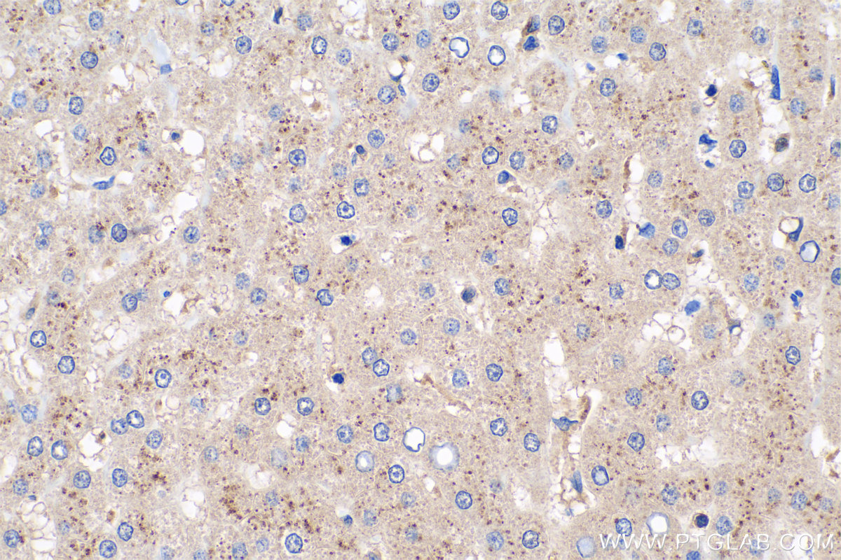 Immunohistochemistry (IHC) staining of human liver tissue using SDSL Polyclonal antibody (16242-1-AP)