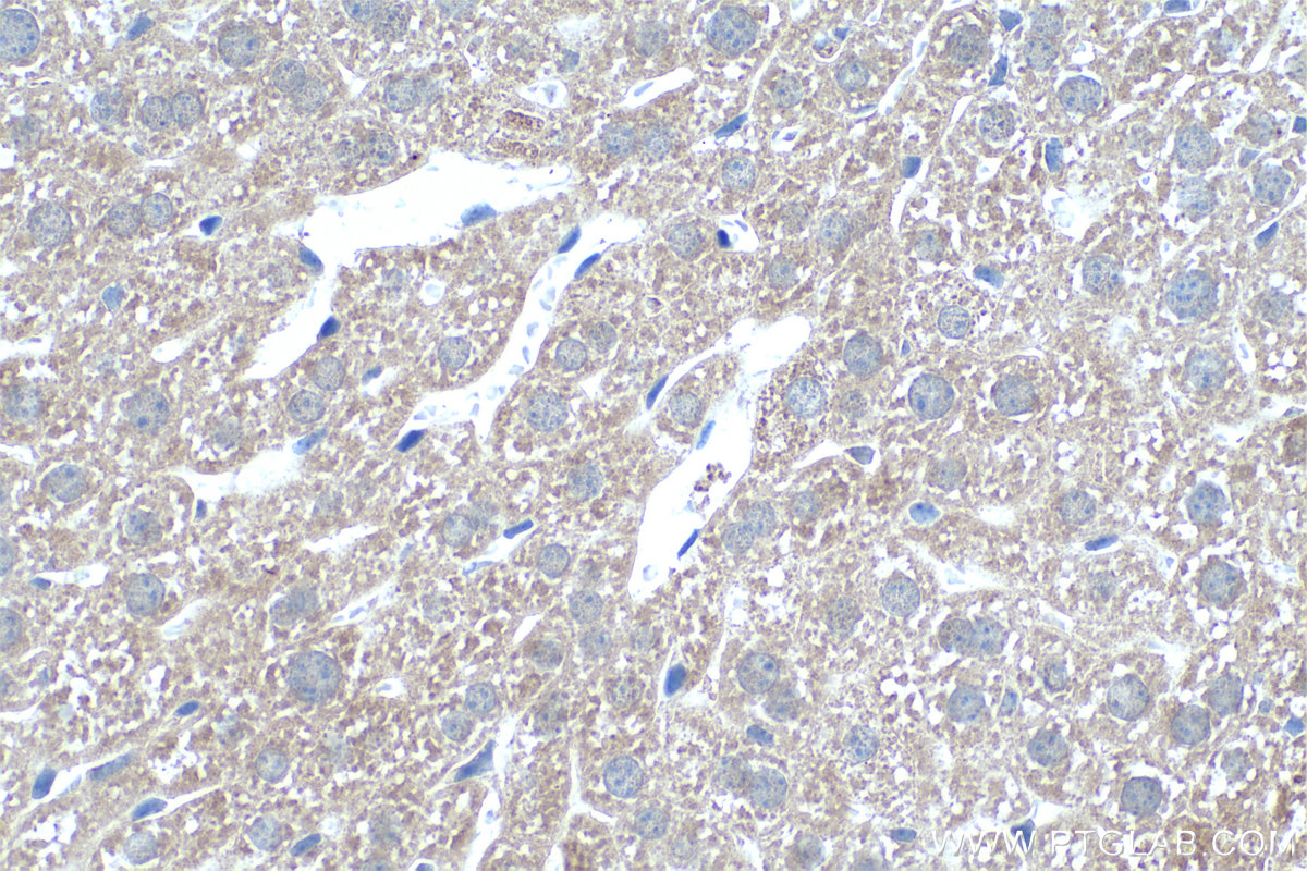 Immunohistochemistry (IHC) staining of mouse liver tissue using SDSL Polyclonal antibody (16242-1-AP)