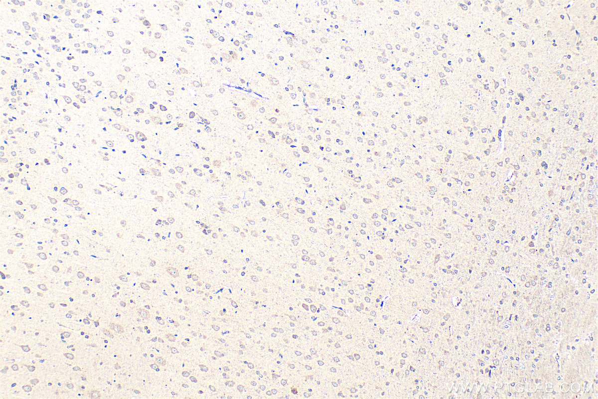 Immunohistochemistry (IHC) staining of rat brain tissue using SEC31A Polyclonal antibody (17913-1-AP)