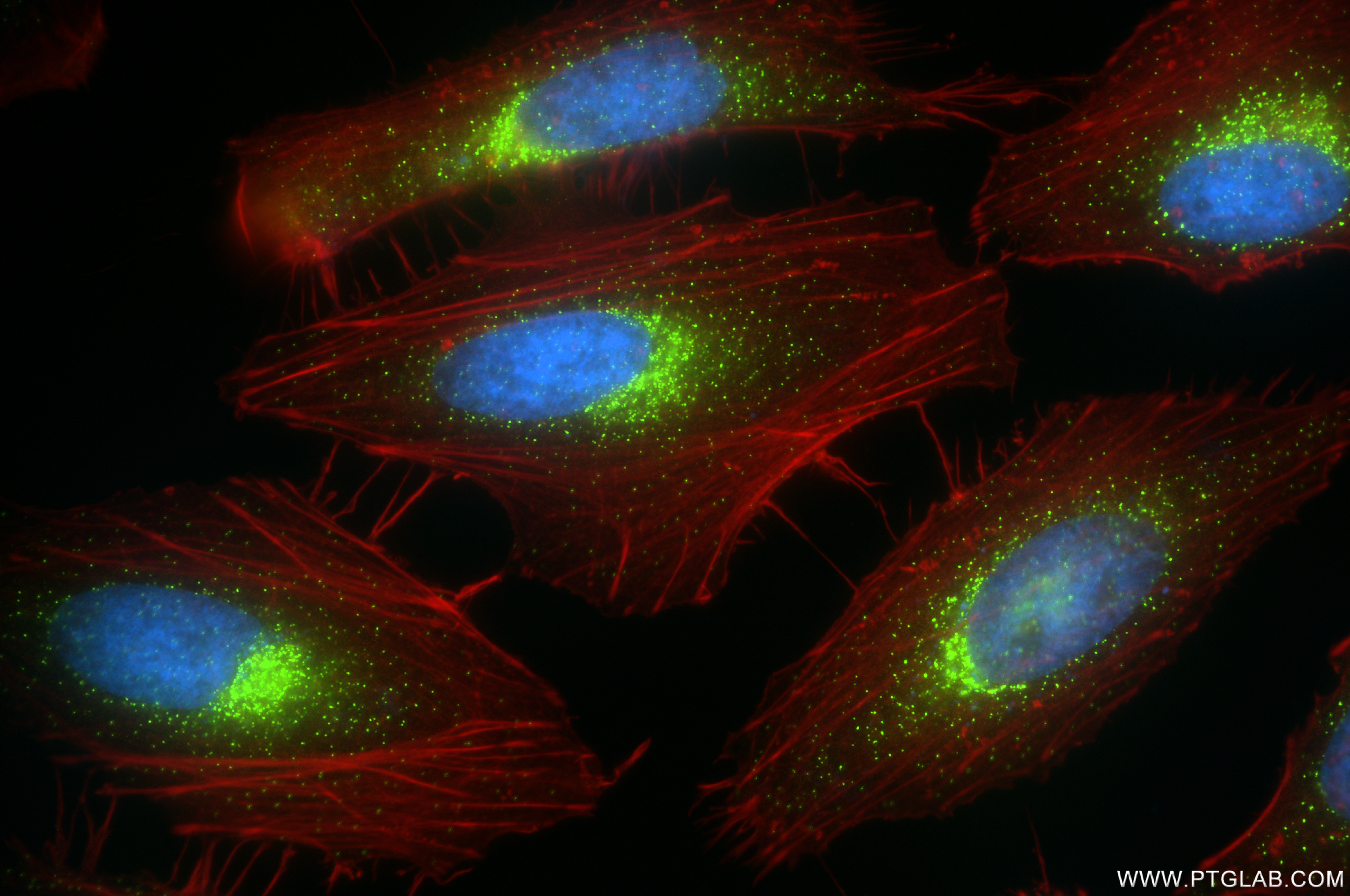 Immunofluorescence (IF) / fluorescent staining of HeLa cells using SEC31A Recombinant antibody (84942-4-RR)