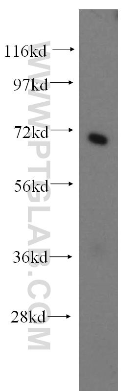 Western Blot (WB) analysis of mouse liver tissue using SEC61 Alpha Polyclonal antibody (15512-1-AP)