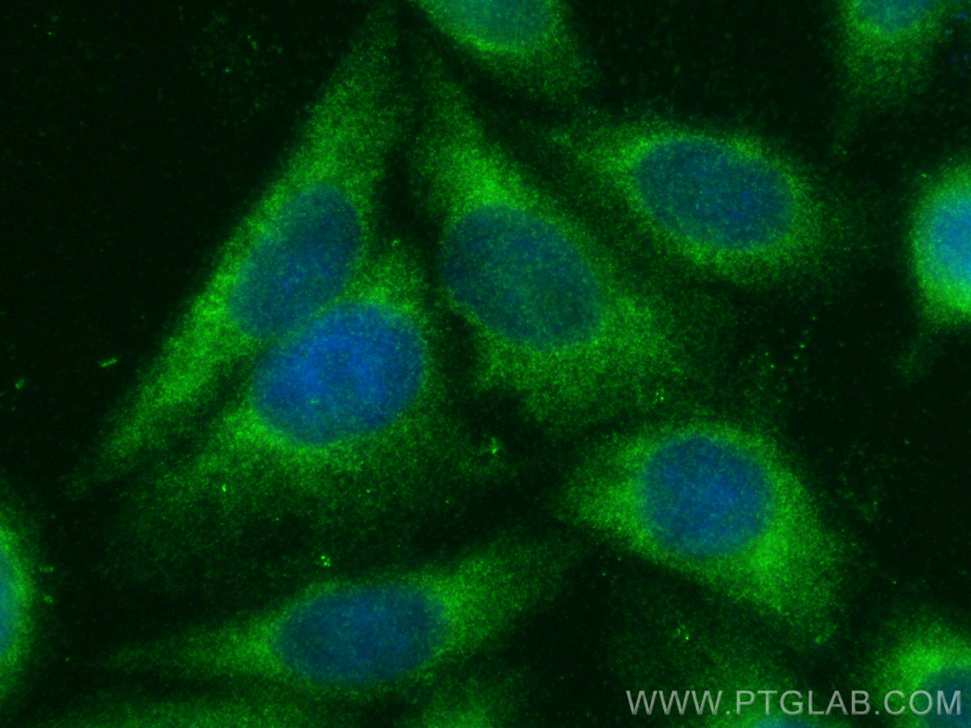Immunofluorescence (IF) / fluorescent staining of HepG2 cells using SEC61B Polyclonal antibody (15087-1-AP)