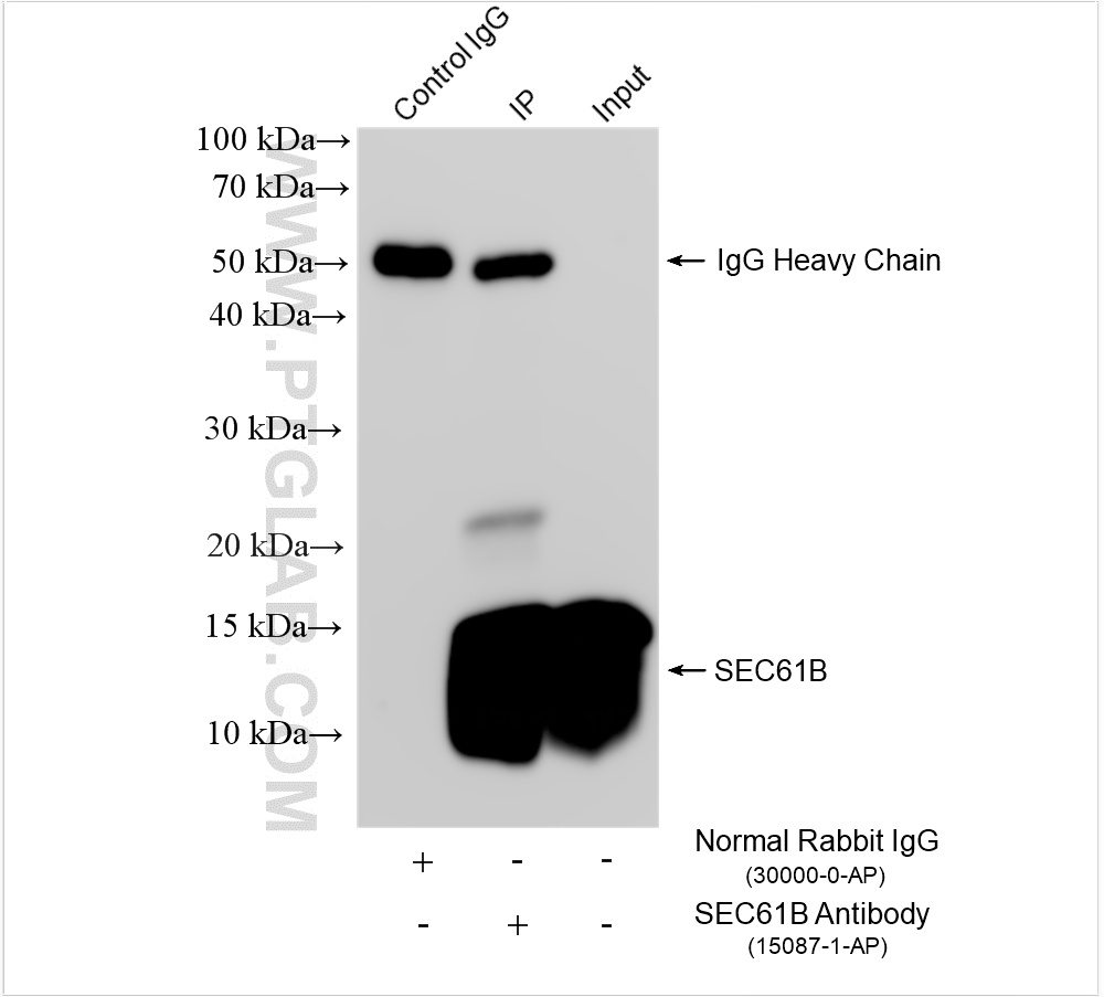 Immunoprecipitation (IP) experiment of HepG2 cells using SEC61B Polyclonal antibody (15087-1-AP)