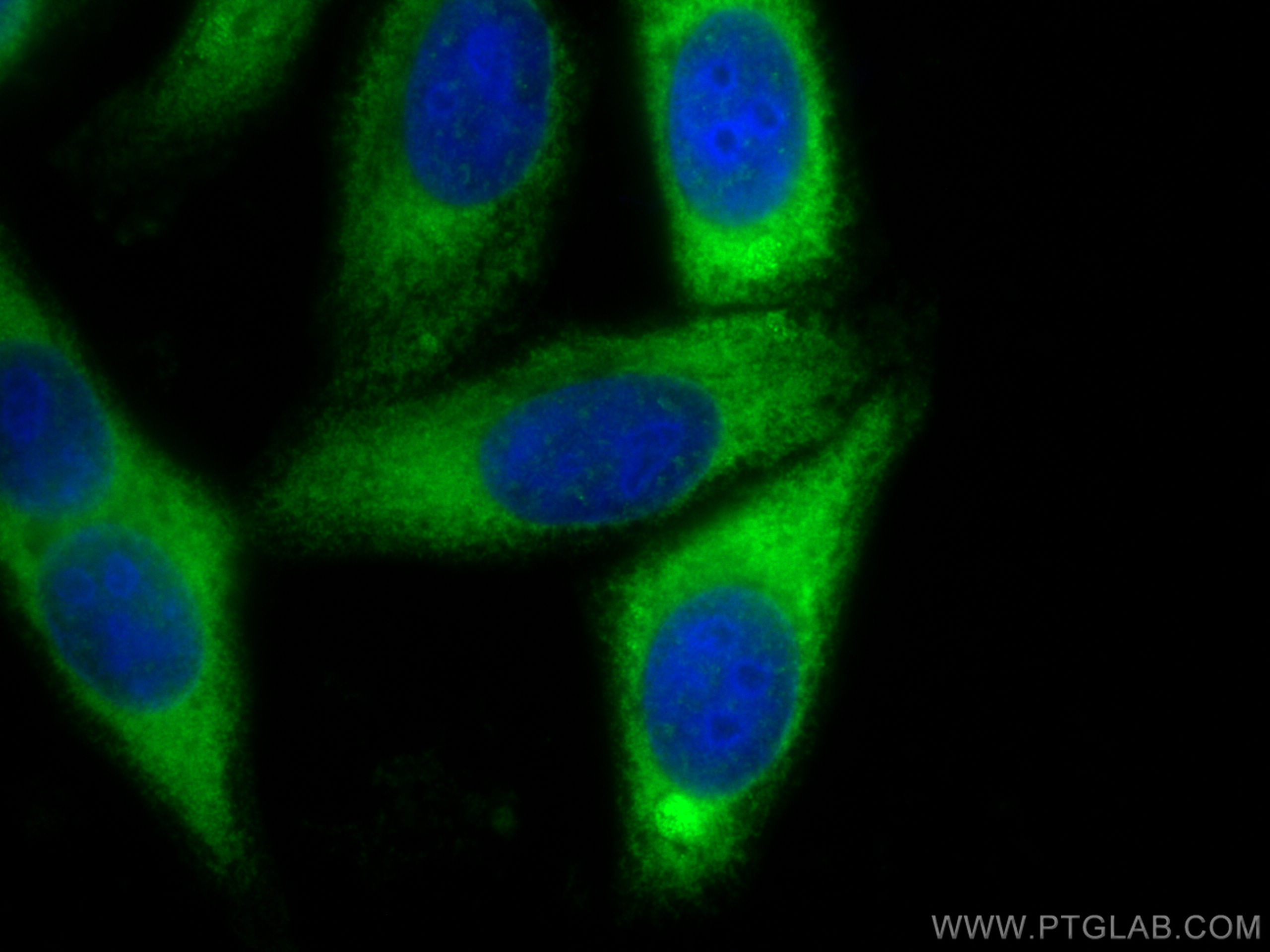 Immunofluorescence (IF) / fluorescent staining of HepG2 cells using SEC62 Polyclonal antibody (28693-1-AP)