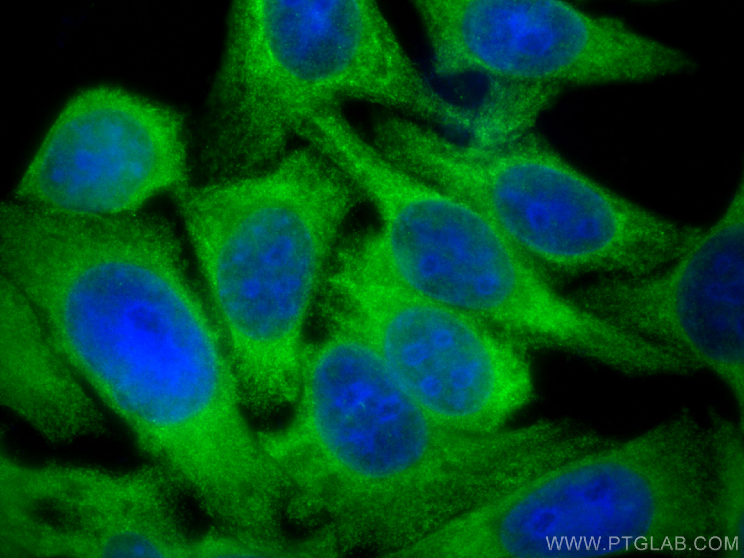 Immunofluorescence (IF) / fluorescent staining of HepG2 cells using SECISBP2 Polyclonal antibody (12798-1-AP)