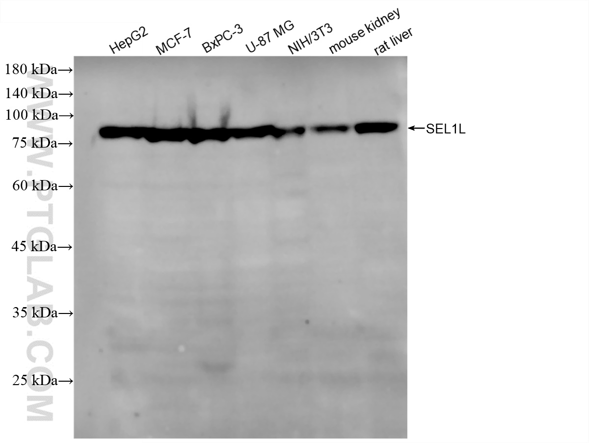 Western Blot (WB) analysis of various lysates using SEL1L Recombinant antibody (84317-7-RR)