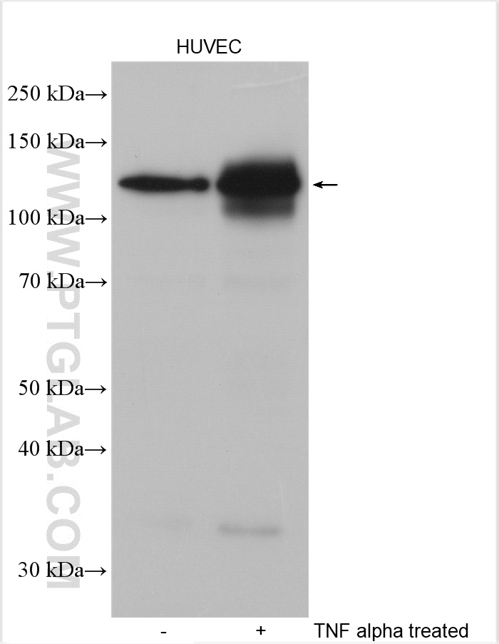 Western Blot (WB) analysis of various lysates using E-selectin/CD62E Polyclonal antibody (20894-1-AP)