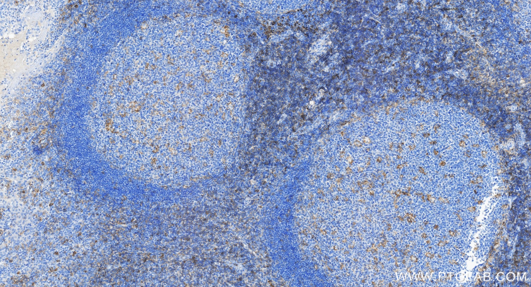 Immunohistochemistry (IHC) staining of human tonsillitis tissue using SELPLG/CD162 Recombinant monoclonal antibody (84500-1-RR)