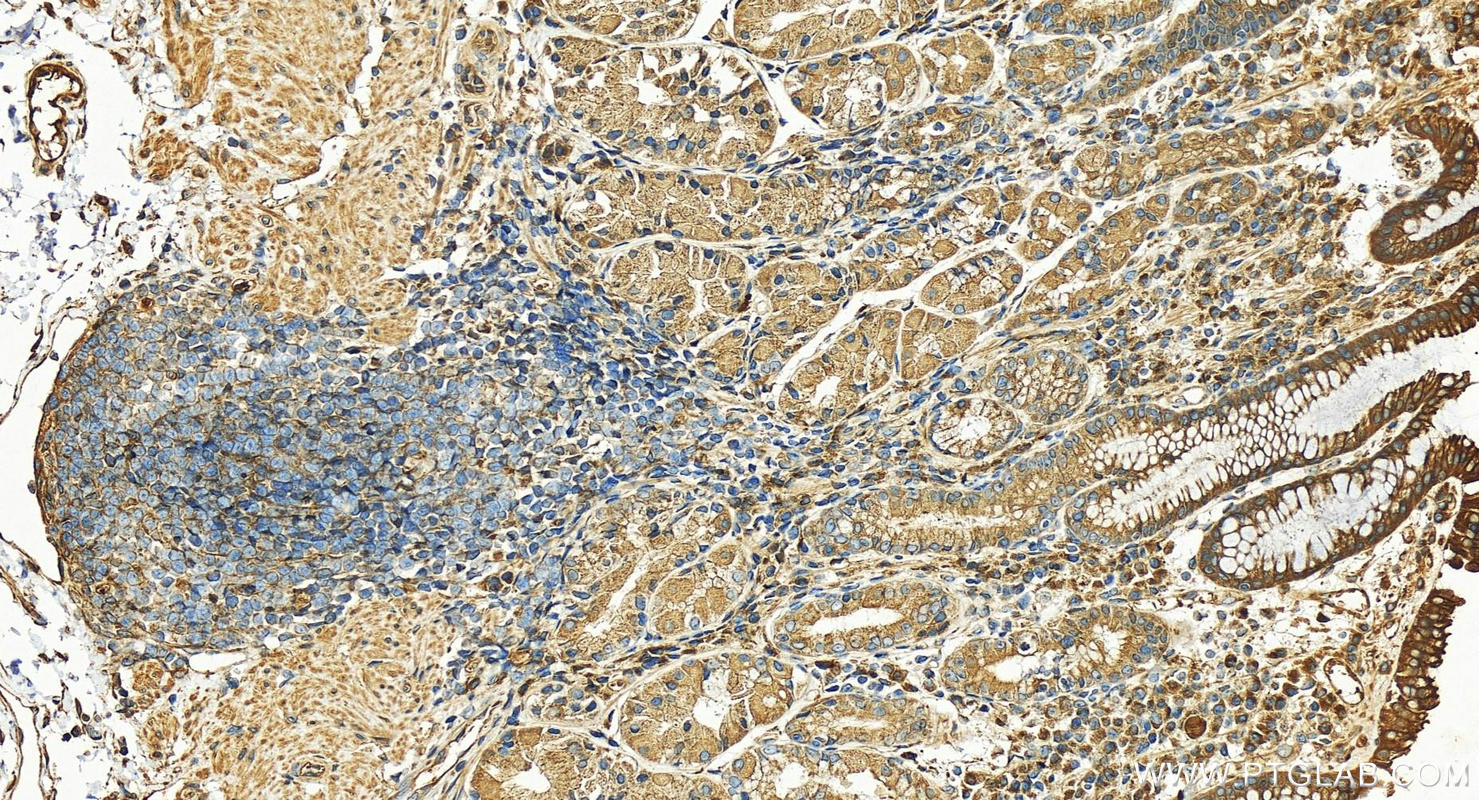 Immunohistochemistry (IHC) staining of human stomach tissue using SELS Polyclonal antibody (15591-1-AP)